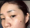 沃森博士氨甲环酸乳膏去黄褐斑传明酸凝胶分解黑色素提亮肤色修护精华液 实拍图