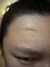 美皮护疤痕贴硅酮祛疤瑞典【双眼皮】2.5X10cm【全网低价】祛疤贴 实拍图
