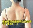 白云山祛痘喷雾淡化痘印控油祛痘痘舒缓前胸后背痘痘皮傲宁水杨酸大容量 实拍图