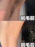仁和匠心脱毛膏男士专用男生腋下腿面胡子须私密处根部去毛膏不永久再生长 实拍图