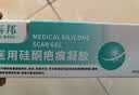 云南白药（YUNNANBAIYAO）泰邦医用硅酮疤痕凝胶去疤膏烧伤烫伤外伤剖腹产甲状腺手术疤 20g 实拍图