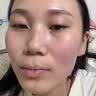OHBT芦荟胶300g保湿补水滋润嫩肤晒后修复祛痘淡印淡化疤痕男女士专用 实拍图