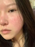 透真修复冻干粉精华液蓝铜胜肽多肽术后修护红血丝角质屏障敏肌泛红 实拍图