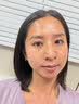 透真祛痘喷雾淡化痘印控油祛痘痘舒缓前胸后背痘痘皮傲宁水杨酸青少年 实拍图