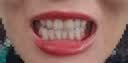 高露洁（Colgate）美白笔 液体牙贴涂抹式亮白去黄去牙渍女生礼物 2.5ml/支 实拍图