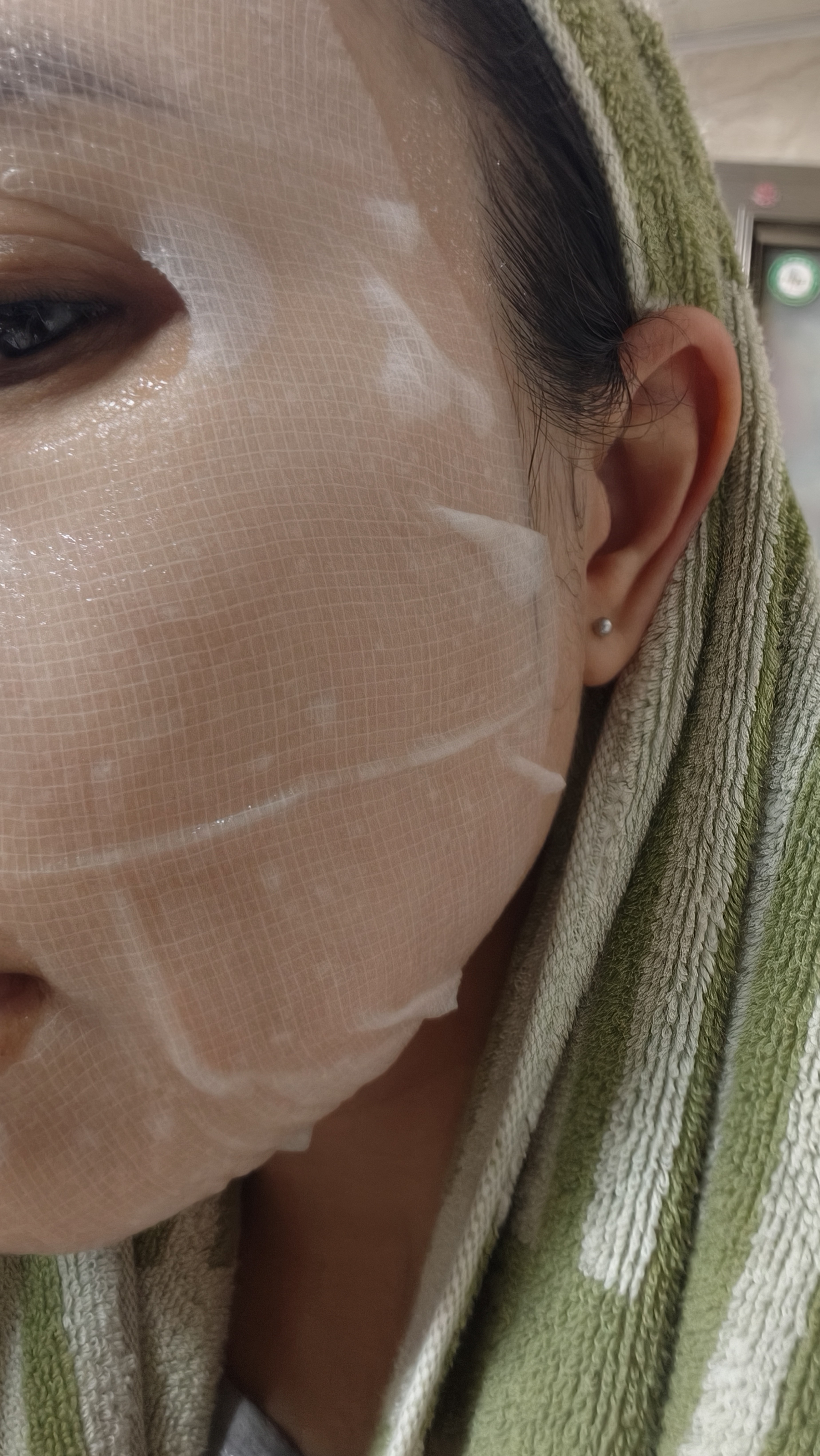 AHC【丁禹兮推荐】三文鱼PDRN水光超膜B5面膜护肤品生日礼物送女友 实拍图