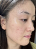 Aromat Herbs澳洲进口祛痘面膜祛痘印补水保湿美白控油收缩毛孔去黄提亮男女士 实拍图