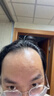 蔓迪【二代米诺地尔】蔓迪5%生发泡沫剂60g*3（倍速温和生发）男女专用治脱发防脱洗发水育发米洛酊搽剂 实拍图