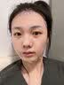 OHBT面膜美白淡斑补水保湿男女士熬夜舒缓抗皱紧致去黄气暗沉提亮肤色 实拍图