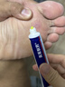 高坂制药鸡眼贴膏去肉刺刺猴药膏无痛脱落连根拔除跖疣专用去脚底老茧20g 实拍图