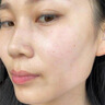 OHBT芦荟胶300g保湿补水滋润嫩肤晒后修复祛痘淡印淡化疤痕男女士专用 实拍图