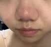 婴儿油收缩毛孔精华液去黑头深层清洁毛孔粉刺按摩保湿正品滋润油 100ml1瓶【婴儿椰子油】收缩毛孔 实拍图