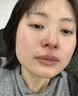 高坂制药鼻炎喷雾剂鼻塞鼻痒神器过敏性鼻炎鼻子痒专用通鼻流鼻涕鼻喷30ml 实拍图