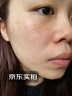 川廿制药熊果苷乳膏精华液去斑黑色素医用脸部改善暗沉男女士搭烟酰胺凝胶 实拍图