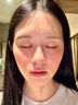 维特丝芦荟胶补水保湿晒后修复凝胶面霜祛痘印收缩毛孔滋润嫩肤男女士 实拍图