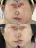 极萌黄星同款负压水光仪自打家用院线美白抗衰祛黄提亮补水嫩肤美容仪化妆镜生日礼物送女生全能弹保价 实拍图