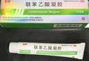 楚舒外用联苯乙酸凝胶3%风湿骨外药膏药贴跌打损痛风药腰间盘突出专用药腰椎压迫神经 实拍图