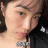 新款赫兹无痛去除红血丝仪器祛斑点痣疣痘印祛黑色素红血丝阻断仪高原红980净丝仪祛红血丝仪器 【多功能】无痛去红血丝+去斑痣 实拍图