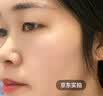 井次制药去痣点痣膏水脸部痦子扁平疣瘊子面部黑痣男女士通用试用装 实拍图