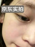 KEORKAO脂肪粒去除药膏神器眼周专用去小颗粒去汗管脂肪瘤消瘤膏清肌眼霜 实拍图
