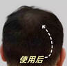 DELIISTON英国生姜防脱洗发水防脱发固发养发非增发密发育控油蓬松老姜王 【一瓶防脱、三瓶增发】正品有防伪 无效全额退 实拍图
