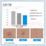 芙清壬二酸清痘精华乳15g祛痘改善黑白头粉刺毛孔修护 实拍图