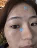 维特丝痘痘贴帖消炎吸脓修复痘印医研舒缓祛痘星星款隐形痤疮专用青少年 实拍图