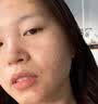 [花容美]阿达帕林凝胶 祛痘药膏祛痘印修复淡化痘印医用祛痘消炎痤疮专用青少年祛痘消炎痤疮专用皮肤用药 0.1%*10g 1盒装 【脸上起粉刺】 实拍图