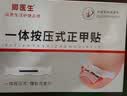 脚医生甲沟炎专用矫正器正甲贴纠正神器嵌甲脚趾甲矫正贴片1套 实拍图