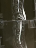 巴迈尔医用级护腰带腰椎间盘突出腰部支撑腰肌劳损男女士专用夏季腰托围 实拍图