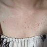 维特丝果酸磨砂膏身体美白去鸡皮肤去角质嫩白全身去死皮男女士搓澡泥宝 实拍图