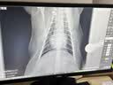 诺泰（nuotai）护腰带医用级腰部支撑腰间盘突出腰肌劳损托椎间盘男女士专用F06 【热销】L码 | 适合体重100-140斤 实拍图