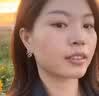 [花容美]阿达帕林凝胶 祛痘药膏祛痘印修复淡化痘印医用祛痘消炎痤疮专用青少年祛痘消炎痤疮专用皮肤用药 0.1%*10g 1盒装 【脸上起粉刺】 实拍图