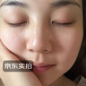 淞町制药脂肪粒去除药膏神器眼周专用小颗粒清肌眼霜袋消除女士重度黑眼圈 实拍图