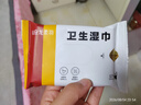 马应龙麝香痔疮膏4g*12支/盒 痔疮专用药消痔疮膏软膏肛裂内痔外痔混合痔肛周湿疹便秘便血去肉球 实拍图