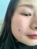 高坂制药点痣膏点斑祛疣药水脸部去黑痣扁平跖疣修复液无痕不留疤非药5ml 实拍图