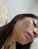 乔记去痘痘和痘印修复凹洞男淡化痘坑消填充再生凝胶生长收缩毛孔医用 膏体*5【想抹平痘坑痘印】多数人选择 祛痘印痘坑修复男生痘印痘坑痘疤修复淡化消除黑色素 实拍图