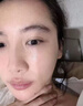 HEBST壬二酸凝胶15%浓度祛痘乳膏淡化祛痘印痘坑修复男士医美用60ml 实拍图