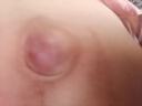 仁和疝气贴婴儿成人脐疝中老年人腹股沟疝可搭疝气专用特傚效药膏内消 2盒实惠装（实收3盒24贴） 实拍图