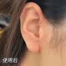 百约王黑棘皮病治脖子黑色素药膏胖人儿童去除腋下沉淀颈部肘关节症专用 单盒装【香港老品牌】50g 实拍图