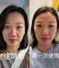 金茉（GEMO）【林允同款七夕礼物】AI智能水光仪大师手打仪器抗衰胶原复配水光针原液自打生日礼物送女友W20AI 实拍图