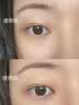 康佳（KONKA）美眼仪眼部按摩仪器美容仪器按摩热敷抚纹焕亮眼周导入仪脸部护理神器生日礼物女生实用毕业送老师 实拍图