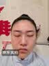 淞町制药面瘫贴后遗症脸部热敷歪嘴眼斜专用口斜面抽蓄痉挛穴位膏药贴神器 实拍图