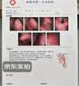 淞町制药慢性咽喉炎专用喷雾剂喉咙痒干咳异物感喉咙有粘痰扁桃体发炎结石 实拍图