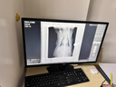 诺泰（nuotai）护腰带医用级腰部支撑腰间盘突出腰肌劳损托椎间盘男女士专用F06 【热销】L码 | 适合体重100-140斤 实拍图