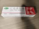 快比宁 红霉素软膏15g 正品消炎抗菌止痒私处祛痘痘痤疮皮肤瘙痒烧烫擦伤外用药唇炎婴儿童非罗红梅素药乳膏 实拍图