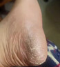 脚裂膏脚后跟干裂开裂干燥脱皮真菌去老茧蛇油皲裂膏手足润肤霜 1瓶试用装【一抹愈合开裂】 一抹愈合干裂去死皮滋润手脚保湿 实拍图