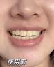维特丝美亮白牙粉去口臭去黄去牙渍去烟渍牙结石牙垢洁牙洗牙牙膏粉50g 实拍图
