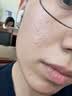 敷尔佳【护肤礼盒】面霜+1黑膜+1白膜+1次抛+小样护肤套装械字号敷料 实拍图
