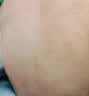 后背痘痘毛囊炎专用喷雾药后背长痘痘前胸后背部脓包除螨祛痘喷剂 一盒装【多买多送】发货特效快 实拍图